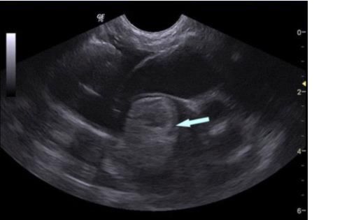 Cat thromboembolism