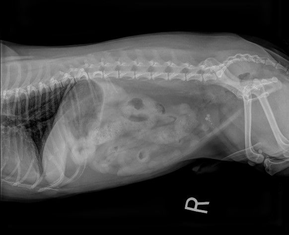 Bladder Stones Xray